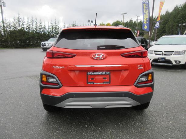 2018 Hyundai Kona image 3
