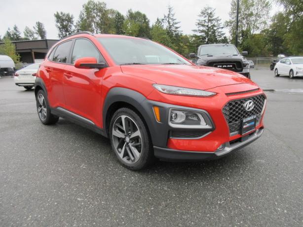 2018 Hyundai Kona image 5