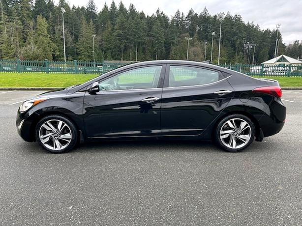 2014 Hyundai  Elantra Sport image 2