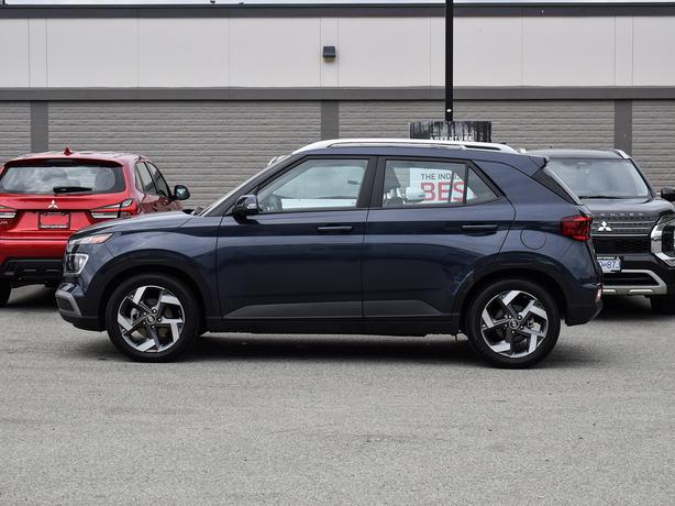 2021 Hyundai Venue Ultimate - No Accidents, Navigation, Sunroof image 2