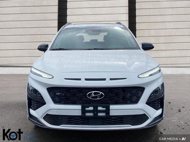 2022 Hyundai Kona N Line - OLD BODY STYLE!! LOVE IT!! image 2