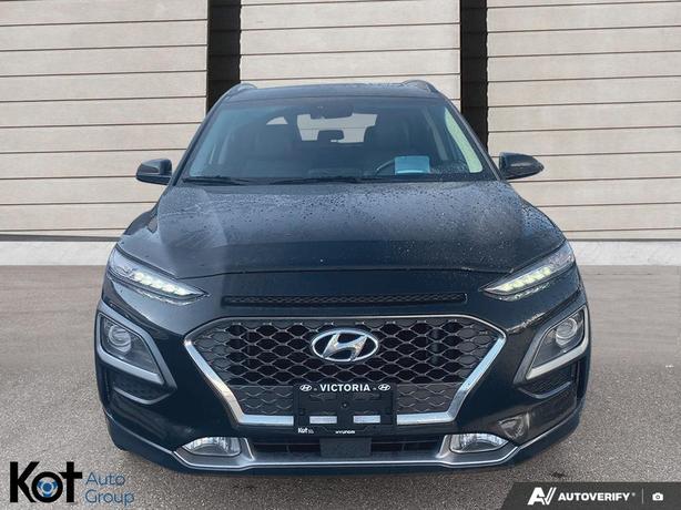 2020 Hyundai Kona Ultimate HEATED AND VENTILATED FRONT SEATS! BLUETOOTH APPLE CA image 2