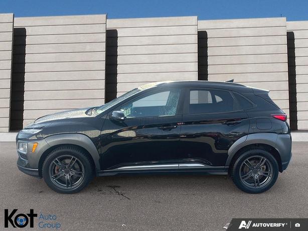 2020 Hyundai Kona Ultimate HEATED AND VENTILATED FRONT SEATS! BLUETOOTH APPLE CA image 3