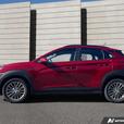 2020 HYUNDAI KONA thumbnail image 3