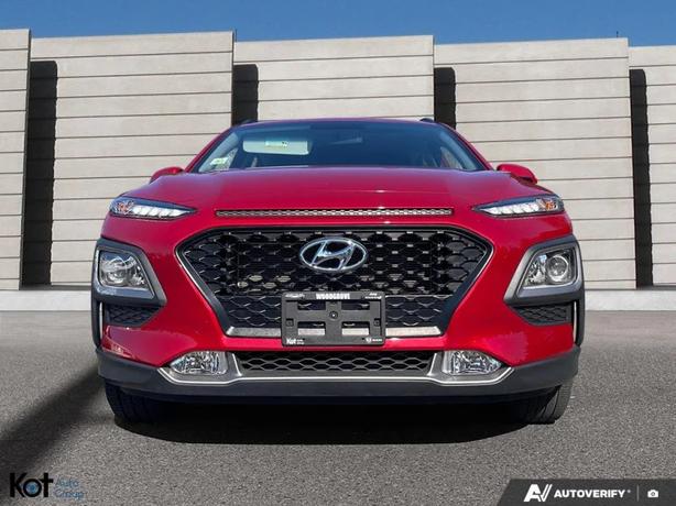 2020 HYUNDAI KONA image 2