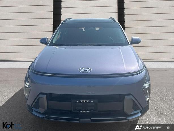 2024 Hyundai Kona Preferred image 2