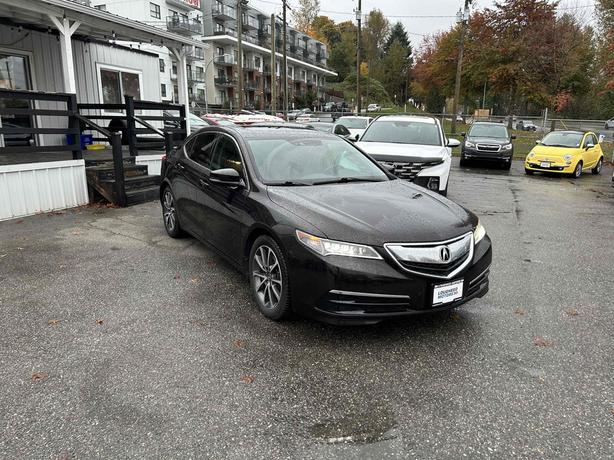 2017 Acura TLX image 1