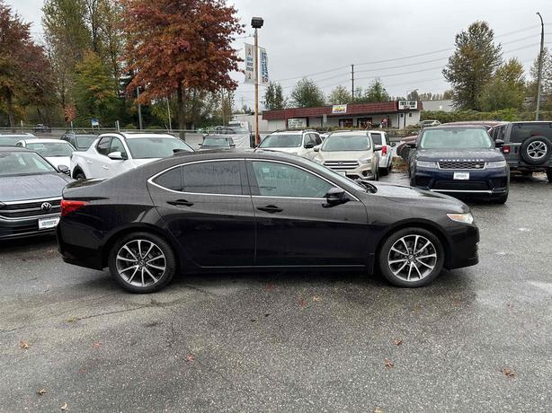 2017 Acura TLX image 4
