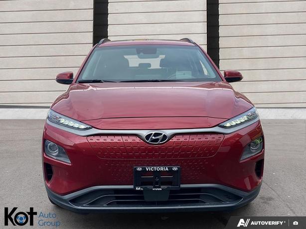 2021 Hyundai Kona Electric Ultimate SUNROOF! LEATHER SEATS! NAVIGATION! HEATED & image 2