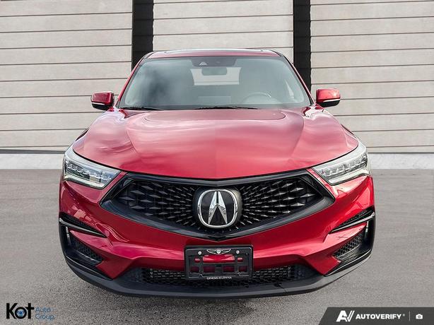 2021 Acura RDX A-Spec image 2