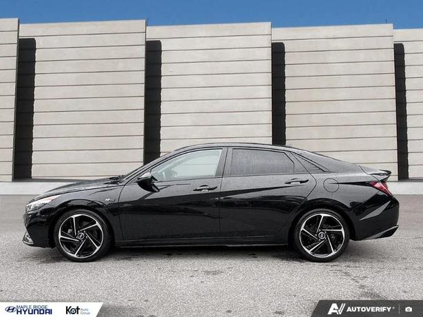 2021 HYUNDAI ELANTRA image 3