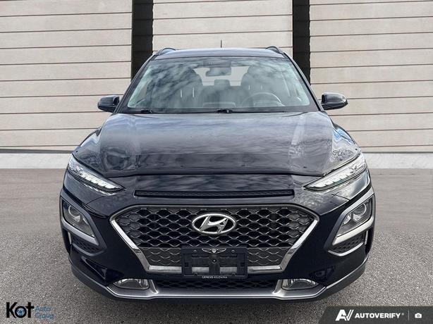 2019 Hyundai Kona Trend KEYLESS ENTRY! BLINDSPOT! BACKUP CAMERA! image 2