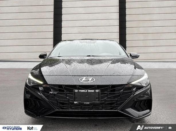 2021 HYUNDAI ELANTRA image 2