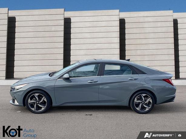 2022 Hyundai Elantra Ultimate LEATHER SEATS! NAVIGATION! SUNROOF! HEATED SEATS!  image 3