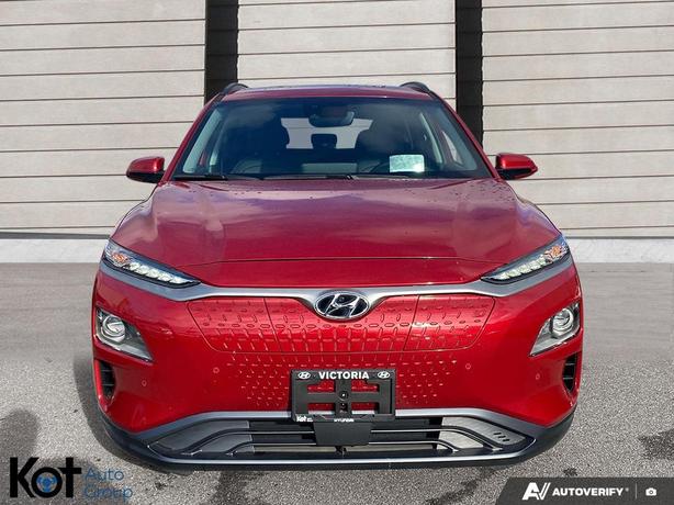 2021 Hyundai Kona Electric Ultimate SUNROOF! LEATHER SEATS! NAVIGATION! HEATED & image 2