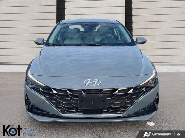 2022 Hyundai Elantra Ultimate LEATHER SEATS! NAVIGATION! SUNROOF! HEATED SEATS!  image 2