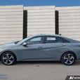 2022 Hyundai Elantra Ultimate LEATHER SEATS! NAVIGATION! SUNROOF! HEATED SEATS!  thumbnail image 3
