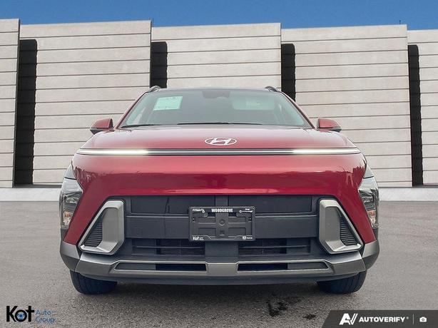 2024 Hyundai Kona Preferred image 2