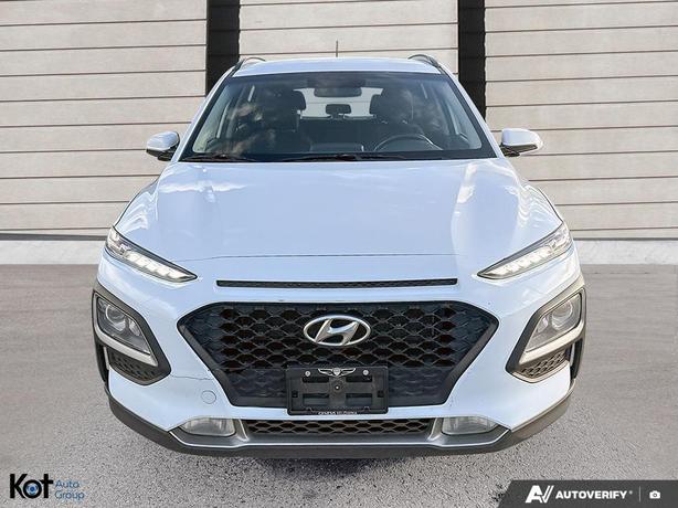 2018 Hyundai Kona Preferred BLINDSPOT! HEATED FRONT SEATS! BACKUP CAMERA! APPLE  image 2