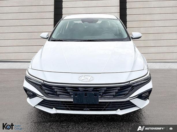 2025 Hyundai Elantra Preferred image 2