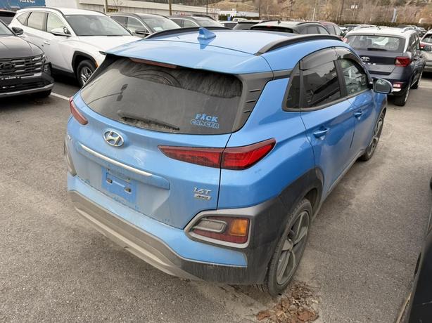 2019 Hyundai Kona Ultimate FULL LOAD! LEATHER! SUNROOF! BACKUP CAMERA! image 4