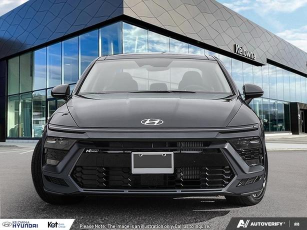 2026 Hyundai Sonata N Line Ultimate SPORT SEATS! FULL LOAD! demo image 2